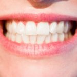 Prześliczne nienaganne zęby dodatkowo świetny uroczy uśmieszek to powód do płenego uśmiechu.